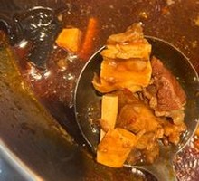 Tendon and Bone