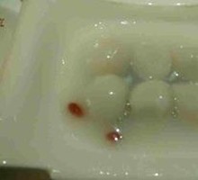 Delicious Shrimp Dumplings