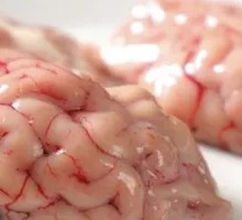 Sheep Brain and Brainstem