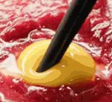 Egg-Custard Pork