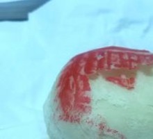 红果白皮儿