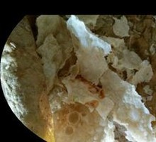 Double Egg Fruit Cake Pancake