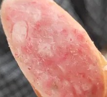老粉肠