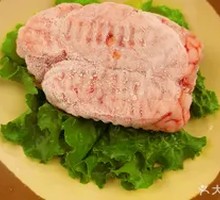 Superior Brain Slices