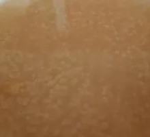 Rice Porridge