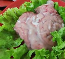Brain tissue