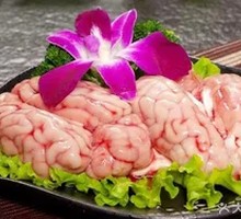 Brain tissue