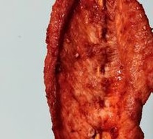 Shanghai-style Pork Tenderloin