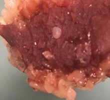 Pork Lard and Red Bean Zongzi