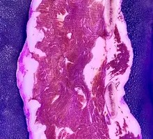 Ribeye Steak