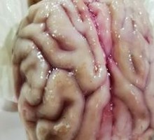 Intelligent Brain Noodles