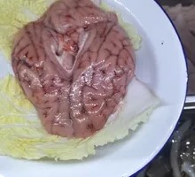 Brain tissue