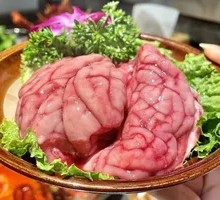 Brain tissue