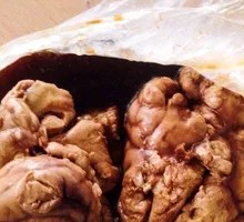 Brain Flower One