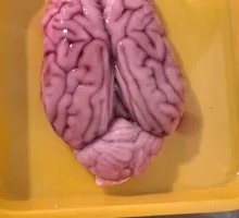 Fresh Brain