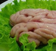 Brain tissue