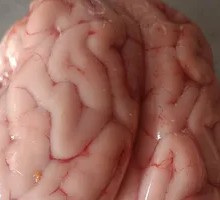 Brain tissue