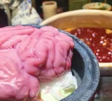 Brain tissue