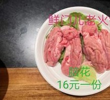 Fresh Brain Tissue