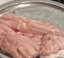Brain tissue