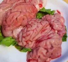 Brain tissue
