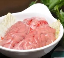 Brain tissue