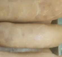 Volcano Sausage