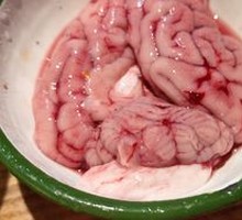 Brain tissue